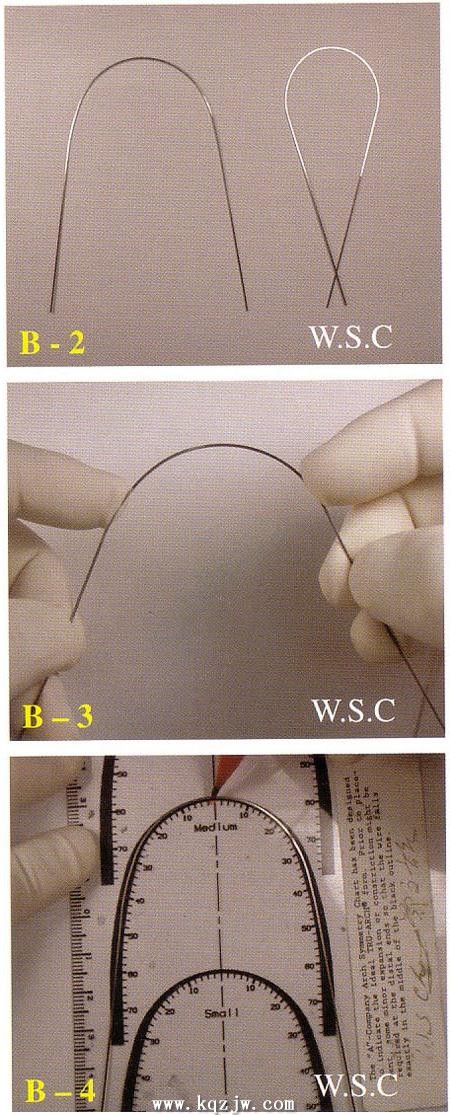 弓丝的弯制是做好矫正的基础一