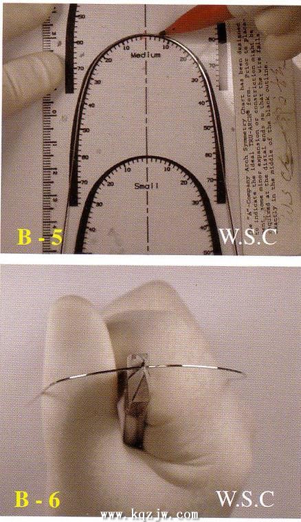 弓丝的弯制是做好矫正的基础一