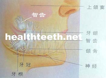 智齿图片