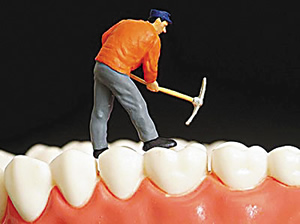 什么是牙釉质发育不全牙釉质发育不全是怎样发生的