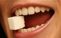 牙周手术后患者应注意哪些问题