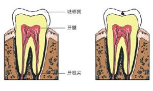 牙周病形成的原因有哪些