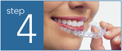 how is the invisalign made?