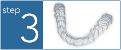 how is the invisalign made?