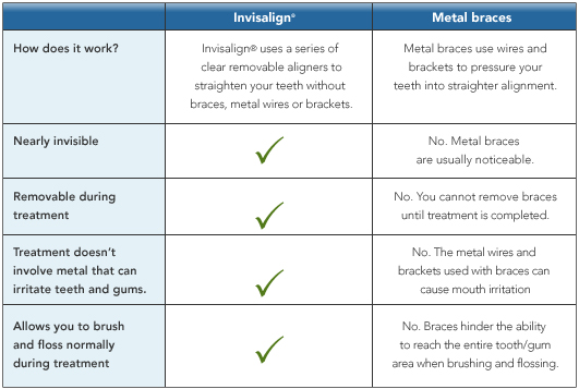 Invisalign treatment comparision