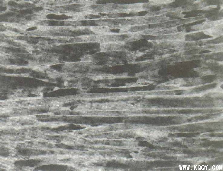 牙齿组织图片之釉柱