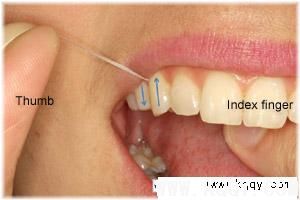 后牙牙线使用方法