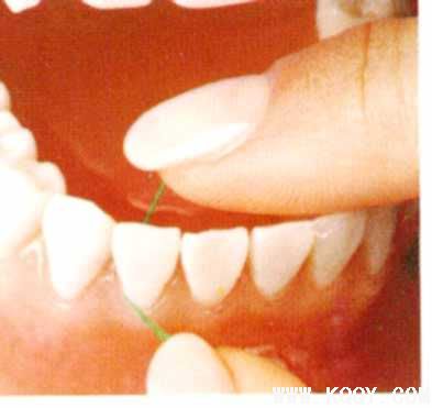 前牙牙线使用方法