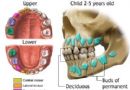 乳牙结构与恒牙牙胚