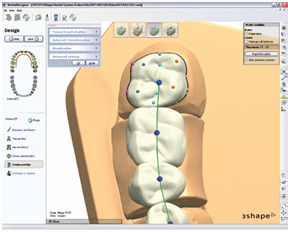 3Shape牙科CAD系统：Dental Designer 2009