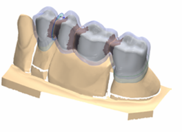 3Shape牙科CAD系统：Dental Designer 2009