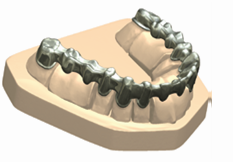 3Shape牙科CAD系统：Dental Designer 2009