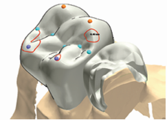 3Shape牙科CAD系统：Dental Designer 2009