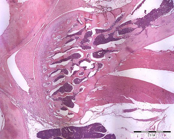 颞下颌关节组织图