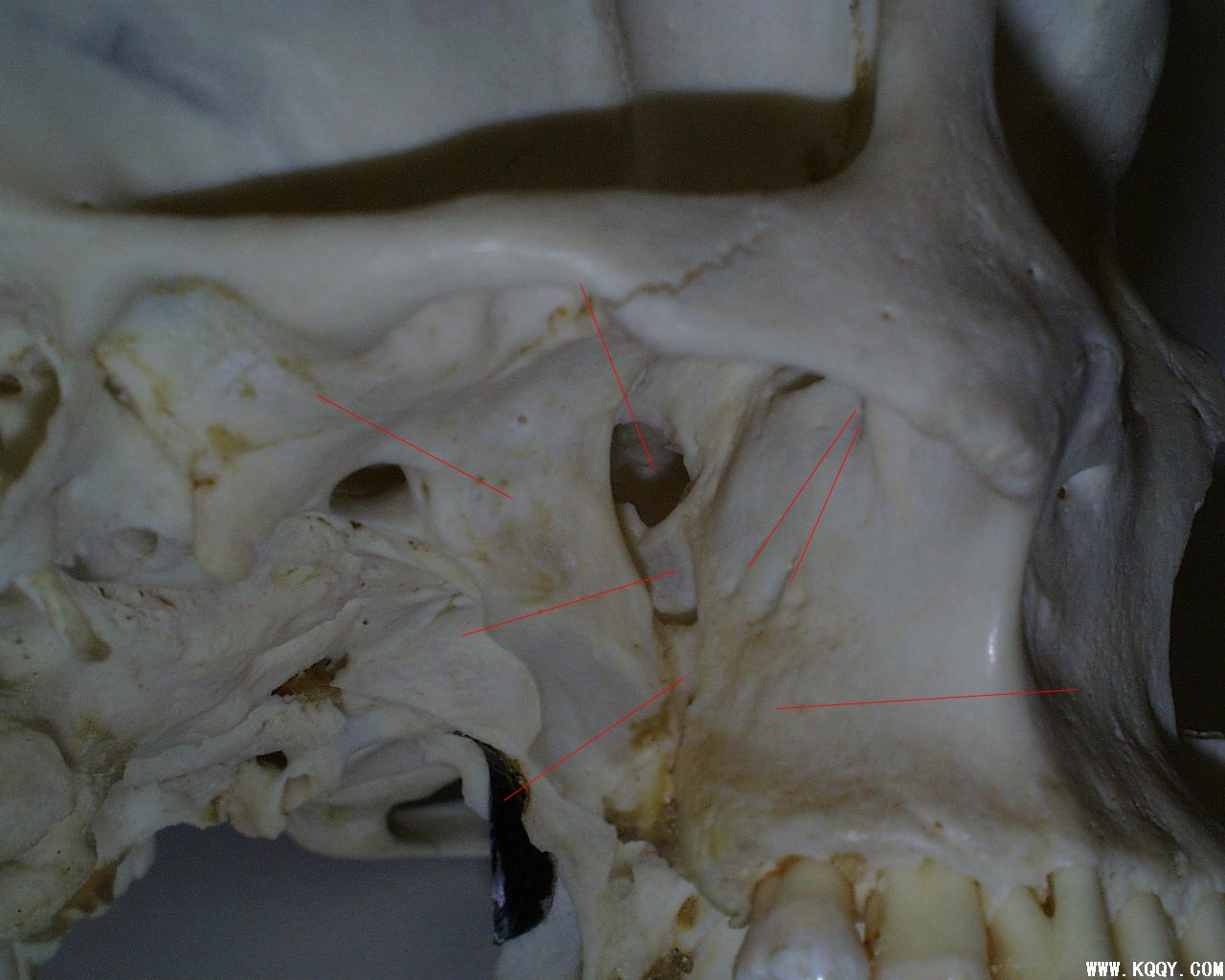 下颌骨实体解剖图