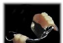 局部可摘义齿临床图片