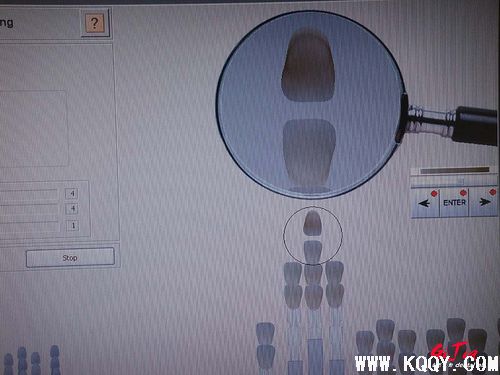 VITA-3D比色板使用学习方法