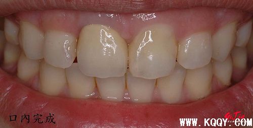 比色板辅助photoshop综合比色方法