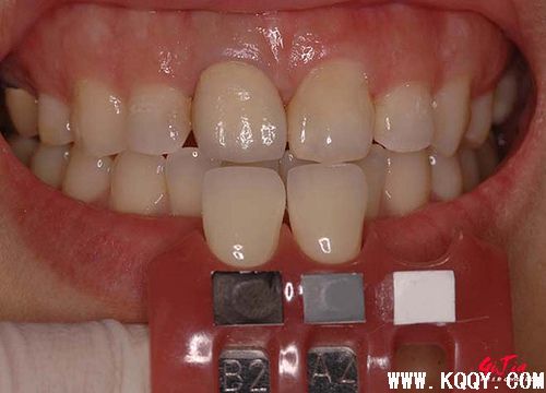 比色板辅助photoshop综合比色方法