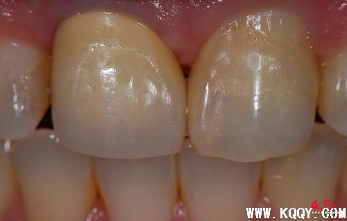 比色板辅助photoshop综合比色方法