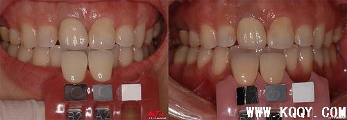 比色板辅助photoshop综合比色方法