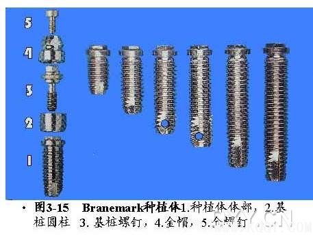 Branemark种植体系统详解