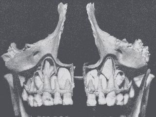 乳恒牙替换解剖图片