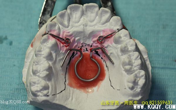 周医生教你认识肌激动器