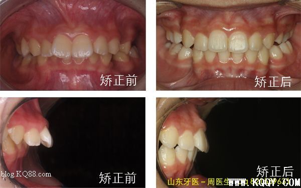 周医生教你认识肌激动器