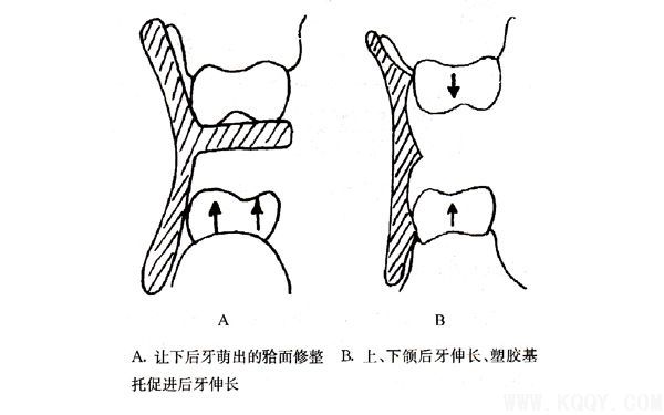 周医生教你认识肌激动器