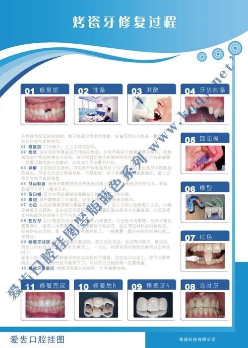 爱齿竖版蓝色口腔挂图——烤瓷牙制作过程