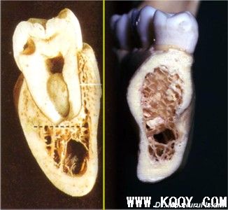 牙槽骨解剖图片（英文）