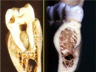 牙槽骨解剖图片（英文）