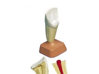 上颌中切牙模型图