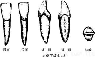 右侧下颌中切牙示意图