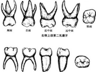 乳牙示意图——右侧上颌第二乳磨牙