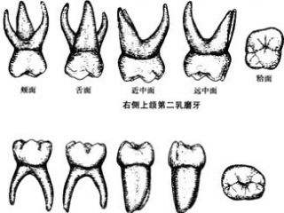 乳牙示意图——右侧上颌第二乳磨