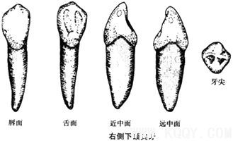 右侧下颌尖牙示意图