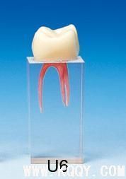 磨牙牙髓模型图
