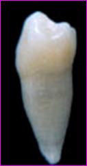 下颌第一前磨牙解剖形态详解