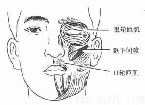 颌周峰窝织炎——口腔颌面部炎症