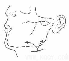 颌周峰窝织炎——口腔颌面部炎症