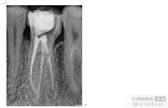 注意!MB2正在悄悄溜走