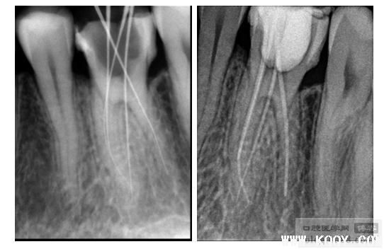 注意!MB2正在悄悄溜走