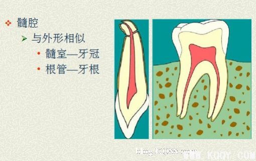 浅析根管口的探查(胡华)