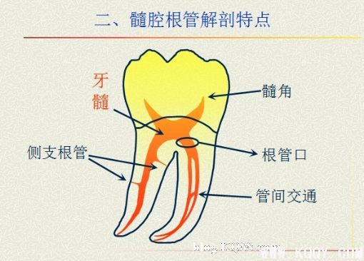 浅析根管口的探查(胡华)