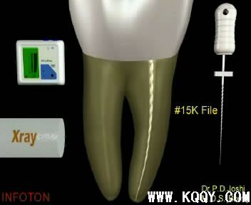 Protaper根管预备操作流程