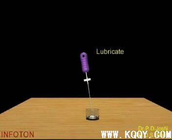 Protaper根管预备操作流程