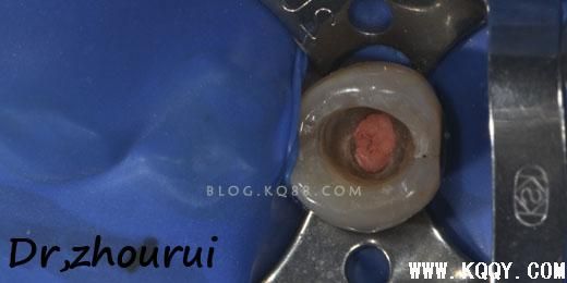 树脂分层堆塑的非技术感悟--周锐