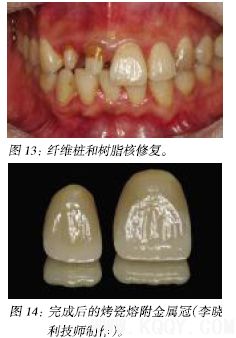 牙齿美学修复中的医技沟通和医患沟通